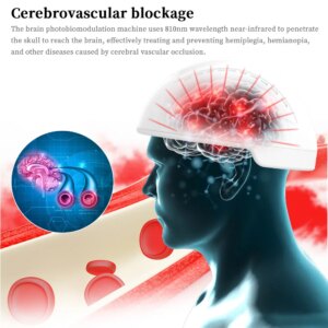 Infrared 810nm Neurofeedback Therapy Machine Pdt Treatment Photodynamic Transcranial Magnetic Brain Photobiomodulation