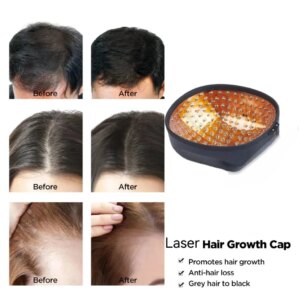 HLKGO Hair Growth Cap 96pcs Laser Therapy for Hair Fast Growth Infrared 650nm Regrowth Anti Hair Loss Relax Scalp Care