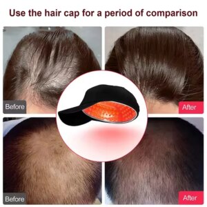 LLLT Hair Regrowth Laser Helmet Anti Hair Loss Treatment Hair Growth Cap Fast Regrow Laser Therapy Device