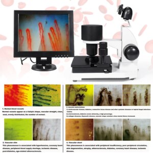 400 times nailfold Capillaroscopy Microcirculation Blood Capillary Microscope Microcirculation/Subhealth detector