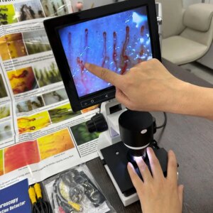 380000 pixels LED light source system Microcirculation microscope Digital microscope HD imported 10X optical magnification