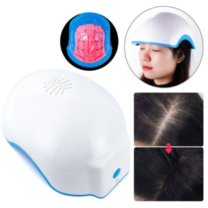 Women and Men’s Light Therapy for Hair Loss Baldness Solution Products