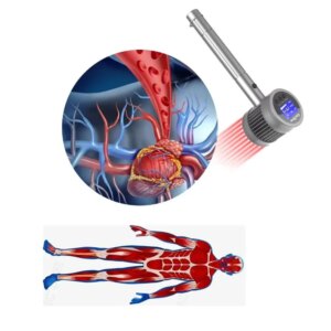 Rechargeable Laser Therapy Device Pain Relief Phototherapy Equipment For Body Pain Relief