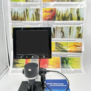 Nailfold Capillary digital usb microscope 8-inch LCD Digital Microscope Biological USB for Blood display