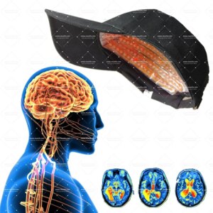 Transcranial photobiomodulation for brain diseases 276pcs 1070NM 26w
