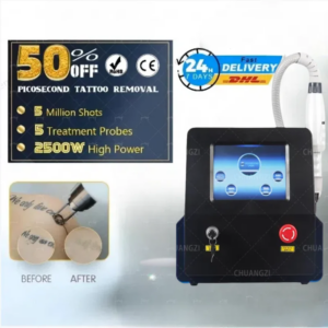 1064nm 532nm 1320nm Advanced Skin Tattoo Removal Equipment Freckle Removal  Nd-yag Q-switched  Pigment Removal Machine