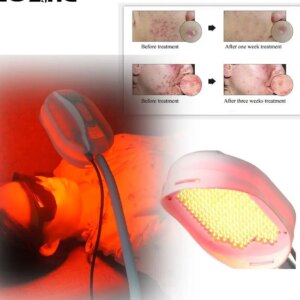 LED Health and Beauty Facial Care System Removes Acne Scars and Wrinkles