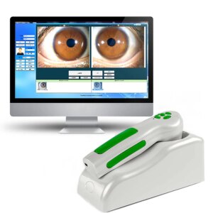 12MP USB Iris Iridology Iriscope Eye Camera Analyzer Digital Iridology Camera
