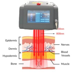 Laser therapy 8W 650nm 808nm for Knee Pain Relief, Hand, Arthritis, Tennis Elbow, Hand Physiotherapy LLLT