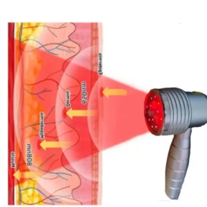 Portable Cold Laser Therapy Machine – 808nm Deep Tissue Penetration for Knee/Back Pain & Inflammation