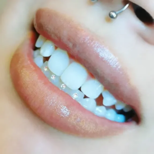 lab diamond crystal gems decoration on teeth