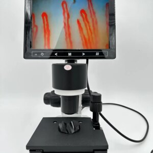 2025 New Wholesale Blood Capillary Nailfold Capillaroscopy Color Microcirculation Detector/Video Capillaroscope