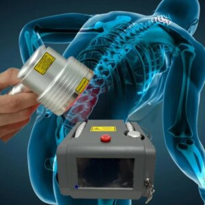 Smart Pulse 1064nm High Power Laser and ESWT Chronic Physiotherapy Device for Pain Relief