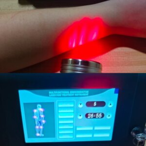 very powerful laser Chronic physiotherapy device For Home Use Tendinitis Muscle Aches