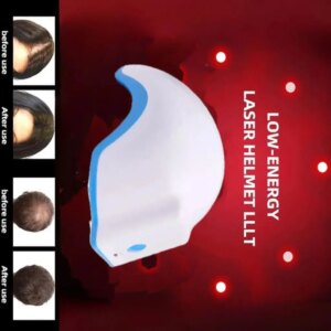 Laser Hair Growth Helmet 80 Diodes 678nm – Stops Hair Loss, Thicker & Fuller Hair in 8-26 Weeks