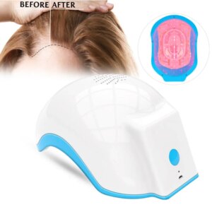 2024 Hair Regrow Machine Home Use Red Blue Hat Led Full Scalp Treatment Therapy Cap For Hair Loss Laser Cap Hair Growth