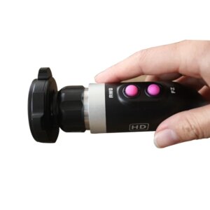 Factory price usb output hd 1080p medical video endoscope usb endoscope camera