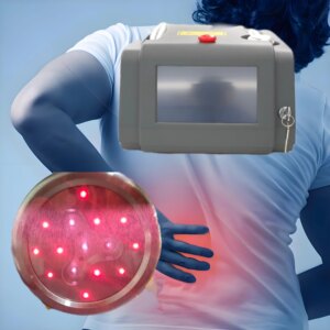 808nm 650nm is used for laser treatment of neuropathy for ligament rupture with rapid effect