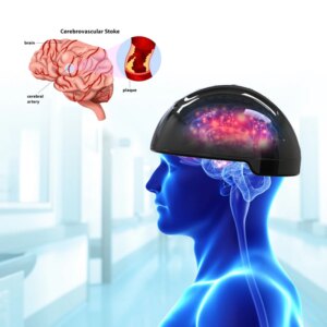 Photobiomodulation Brain Wave Helmet 810nm Infrared LED Light Therapy For Stroke Parkinsonism Disease Mental Illness Treatment