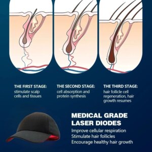 Laser Hair Regrowth Cap, Anti Hair Loss Hair Strengthener, Unisex, Red Light Helmet
