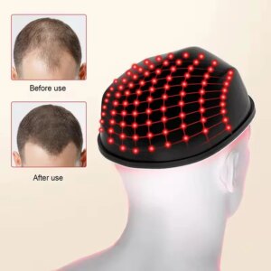 LLLT Hair Loss Treatment Machine Hair Regrowth Cap Hair Growth Helmet
