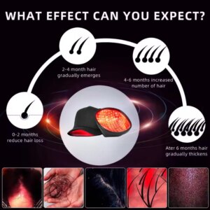 Professional 96 Laser Hair Growth Cap LLLT Therapy Hair Loss Treatment for Androgenetic Alopecia Laser Cap Superior Coverage