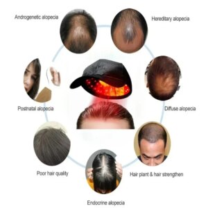 Laser Hair Growth Cap Men and Women Hat Hair Restore Enhance Hair Roots Scalp Care Treatment Device