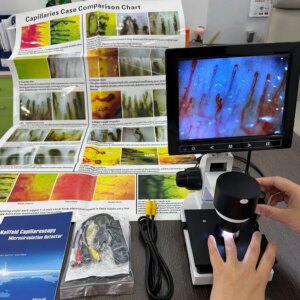 8 Inch Healthcare Beauty Device Fingernail Capillaroscope Detection HD camera Instrument 880 Model Microcirculation Microscope
