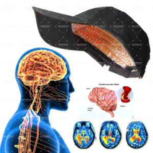 Brain healthy brain cell recovery 810nm brain injury cell repair cap