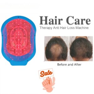 Home Use Laser Hair Loss Machine LLLT Helmet 80 Diode Cap For Hair Regrowth