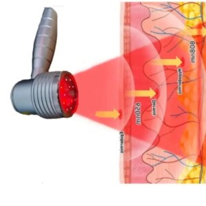 650nm+808nm Dual-Wavelength Laser Therapy Tech for Fast Wound Healing & Nerve Repair