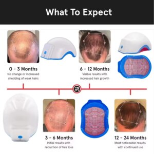 Reduce Hair Loss Hair Growth Products women’s underwear massage LLLT Laser Cap