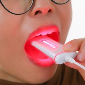 Dental Ulcer Instrument Light 14x Powerful Red Light Oral Physiotherapy Teeth Lip And Mouth Physiotherapy Suitable for Home Use
