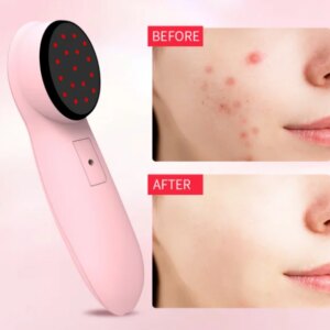 Laser TreatmentsAnti-AgingAcne TreatmentsWrinkle ReductionFull Face Neck TreatmentsLaser Cosmetic Devices