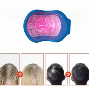 80 LEDs Red Light Laser Hair Growth Helmet for Anti hair loss laser hair regrowth therapy for Women&Men