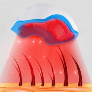 Laser Hair Growth Helmet Laser Hair Regrowth 80 Medical LLLT Diode Cap Hair Loss Treatment Device