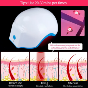Hair Infared Regrow Laser Helmet 80 Medical Hair Treatment Diodes Hair Loss Fast Hair Solution Regrowth LLLT Laser Cap