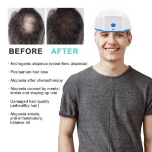 Hair Regrow Helmet LED Red Light Therapy Hair Growth Cap Laser Treatment Hair Loss Device Medical Men Women Hat