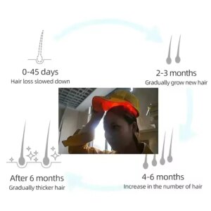 Laser Therapy Hair Growth Helmet Anti Hair Loss Device 96pcs Lamp Beads Red Light Promote Hair Regrowth Cap