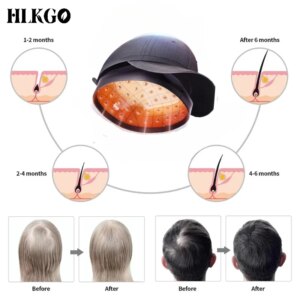 96pcs Laser hair growth cap LLLT Hair Growth Regrowth Helmet Reduce Hair Loss Laser Cap