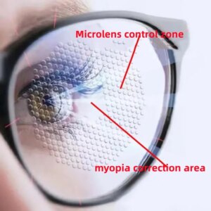 Customize 1.67 Multi-point Defocus Anti-blue Lenses for Kids Teenagers Eyes Relief Children Control Kid’s Myopia Hyperopia