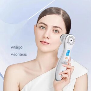 308nm LED UVB Phototherapy Vitiligo Psoriasis Lamp B4