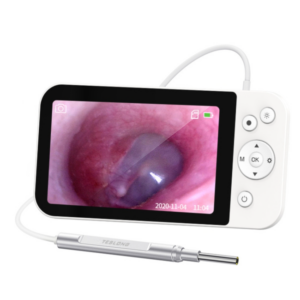 Telstar MS500 5″ HD Large Screen Illuminated Ear Spoon 3.9mm Diameter Visual Ear Collection Tool // Telstar MS450 4.5″ HD Smart Screen Otosc
