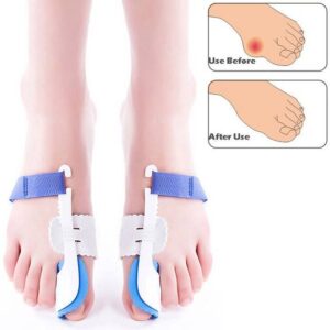 ZRWC14 hallux valgus corrector night use toe orthosis 1 pair sold