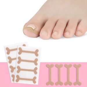 10 sets of nail correction patches with embedded nail groove patches for sale